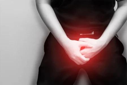 Benarkah Kutil Kelamin Bisa Kambuh meski Sudah Diobati?