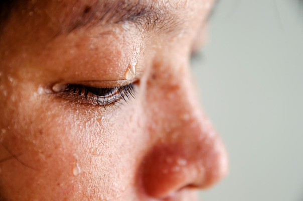 Braune Flecken Am Bein Diabetes The Secret To Staying Healthy - mlf8wo4
