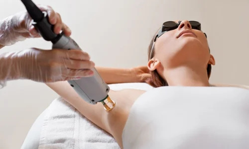 IPL Hair Removal, Prosedur Menghilangkan Bulu dengan Cepat