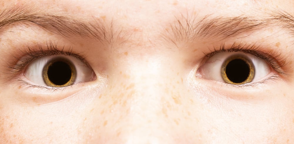Midriasis, Kondisi Ketika Pelebaran Pupil Mata Tidak Normal