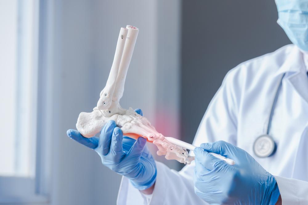 Memahami Kapan Cangkok Tulang Diperlukan dan Prosedur yang Dilakukan