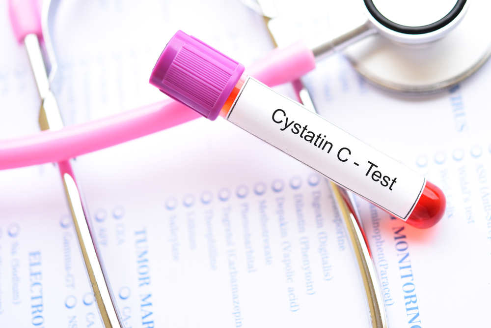Mengulik Tes Cystatin C untuk Deteksi Gangguan pada Ginjal