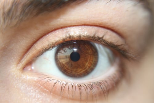 kelainan pada pupil mata