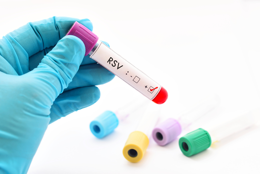 Mengenal RSV (Respiratory Syncytial Virus), Infeksi yang Menyerang Pernapasan