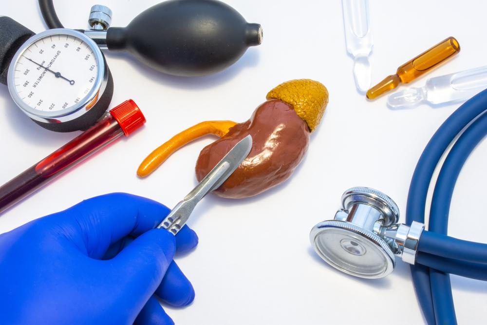 Nefrektomi (Operasi Pengangkatan Ginjal)