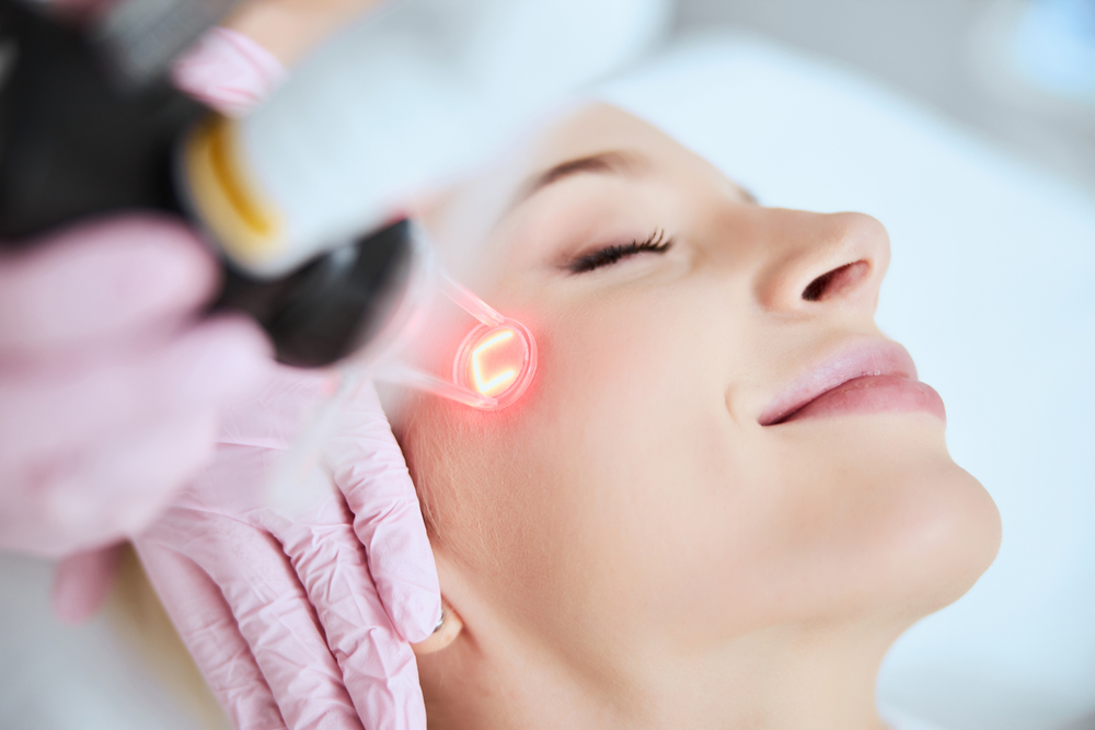 Mengulik Perawatan Laser CO2 untuk Kecantikan Wajah