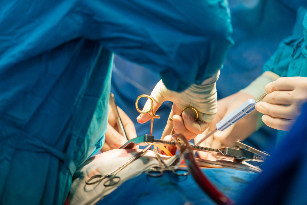 Transplantasi Paru, Prosedur Pembedahan untuk Mengganti Organ Paru