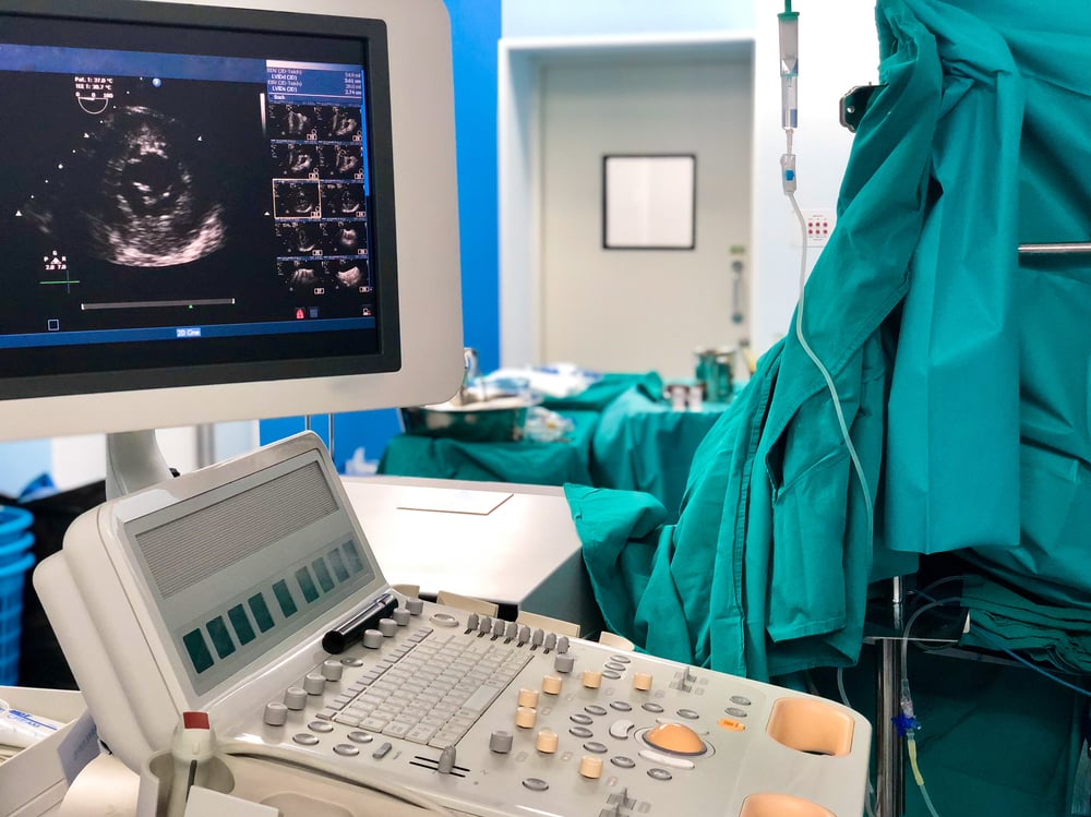 Transesophageal Echocardiogram