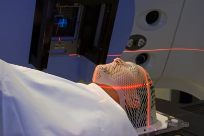 Radioterapi pengobatan kanker nasofaring