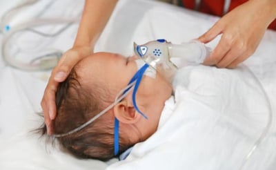 RDS pada bayi