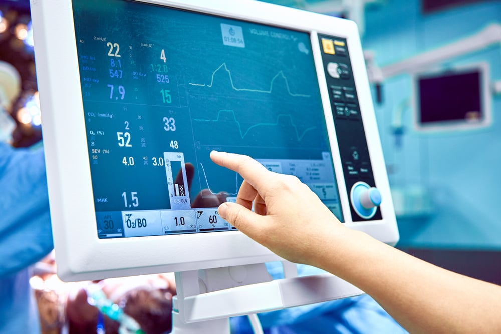 Bagaimana Cara Membaca Hasil Tes EKG?