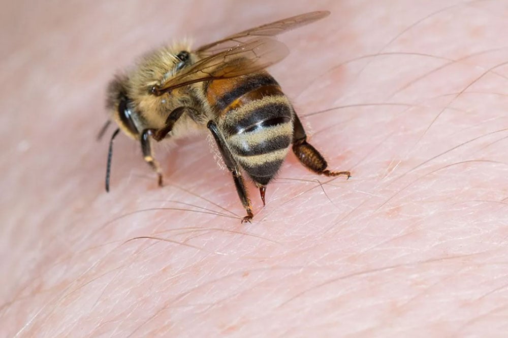Alergi Sengatan Lebah, Kenali Gejala dan Cara Mengatasinya