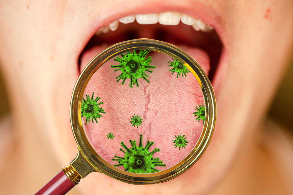 Mengenal Bakteri Mulut dan Dampaknya bagi Kesehatan