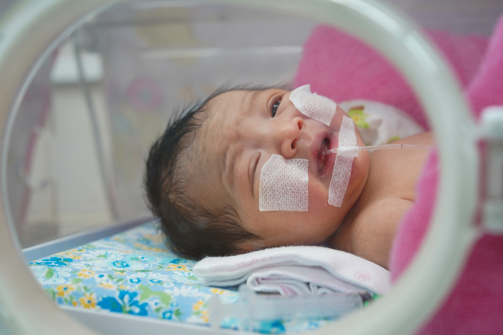 Mengenal CHARGE Syndrome, Penyebab Kelainan di Banyak Organ Tubuh Bayi