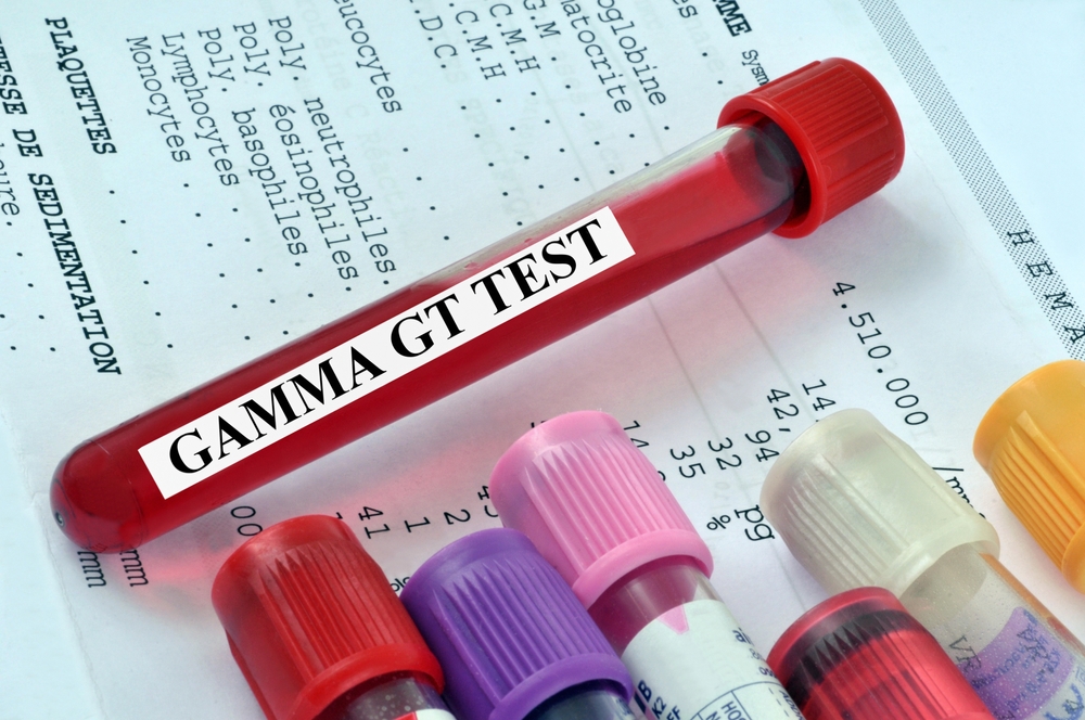 Prosedur Tes Gamma GT untuk Deteksi Penyakit Hati