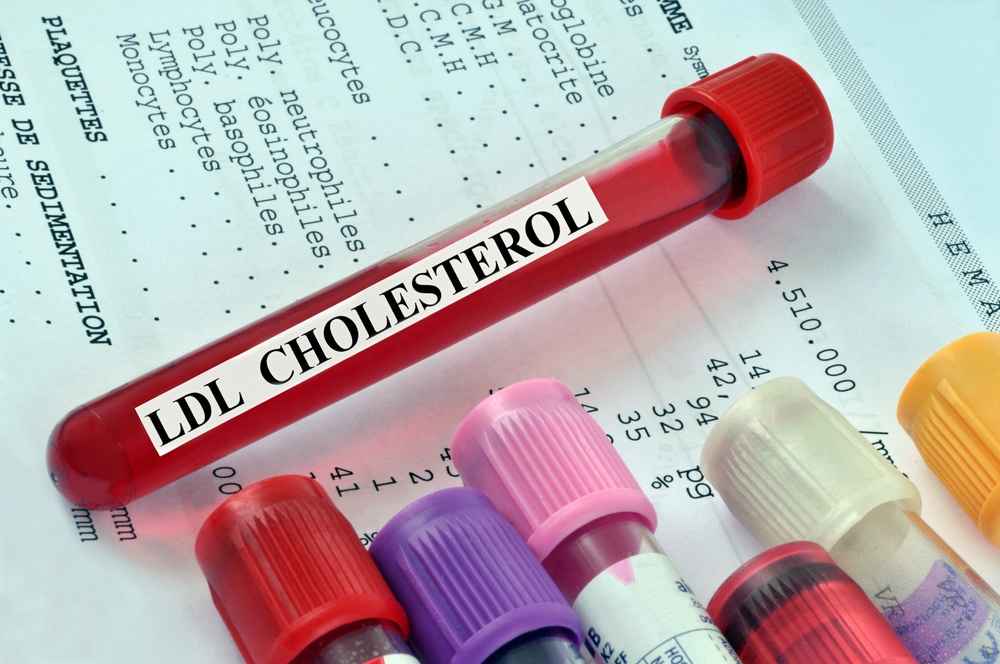 Kolesterol LDL: Kadar Normal, Gejala Tinggi, Cara Mengontrol