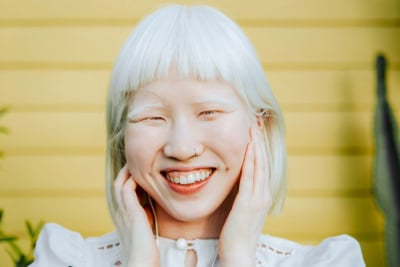 komplikasi albino albinisme