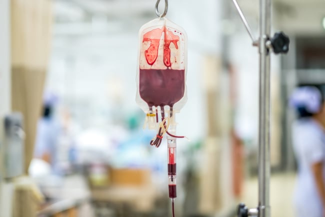 Transfusi Tukar: Tujuan, Prosedur, dan Risikonya