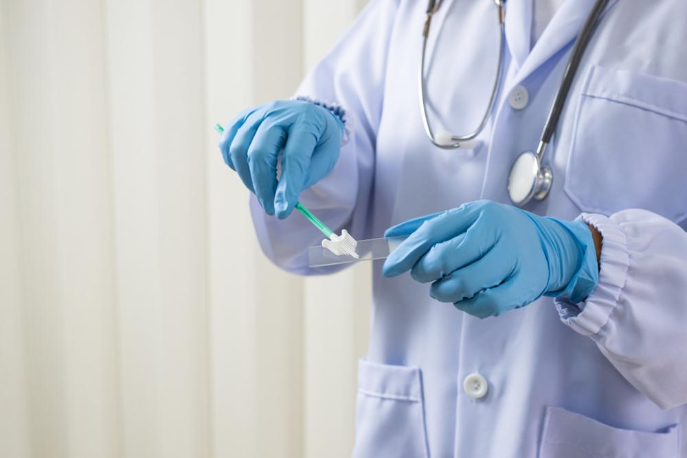 Tes HPV DNA: Pengertian, Tujuan, Prosedur, Biaya