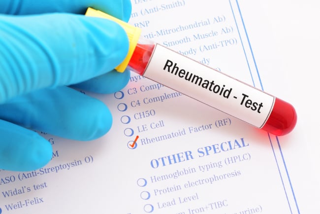 Pemeriksaan RF (Rheumatoid Factor): Fungsi, Risiko, dan Prosesnya