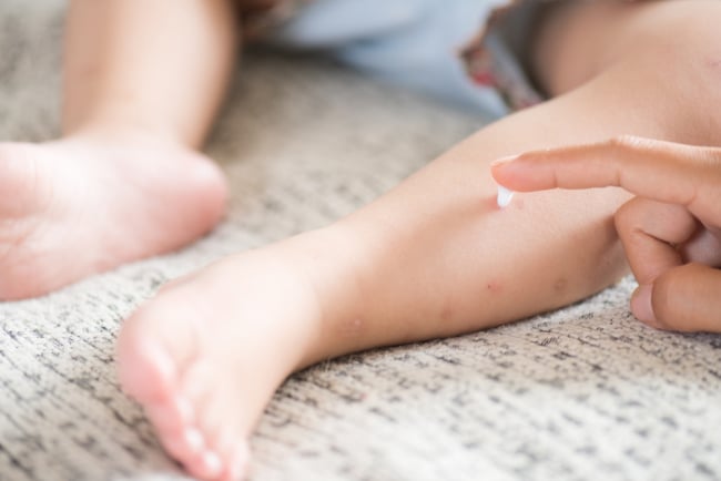 7 Rekomendasi Lotion Anti Nyamuk yang Aman untuk Lindungi Bayi