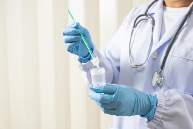 bahaya pap smear