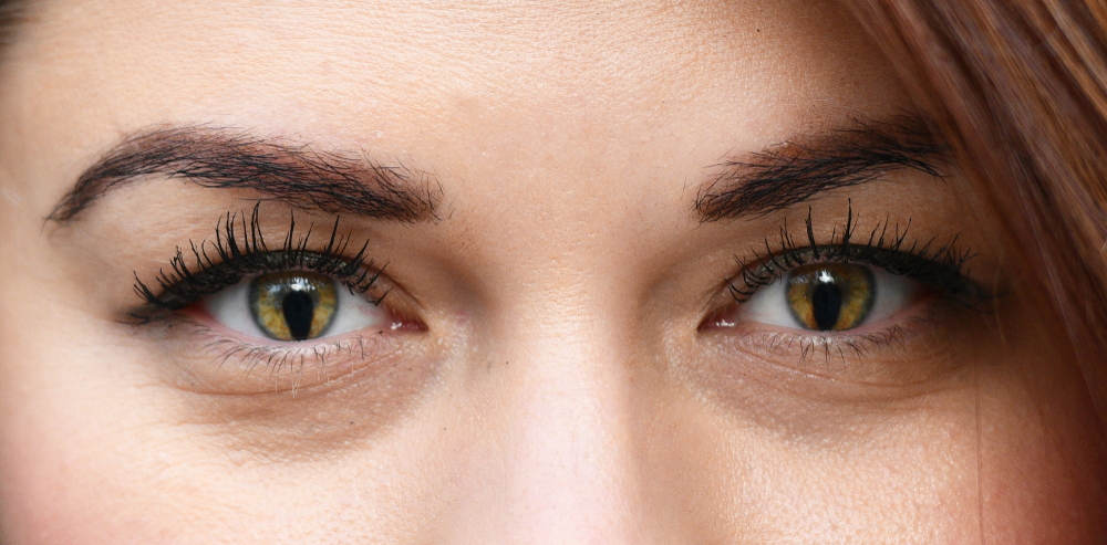 Coloboma, Kelainan yang Membuat Pupil Mata Seperti Mencair