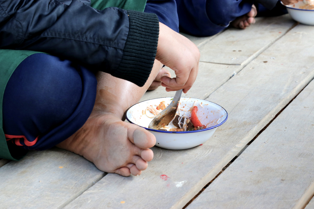 Sama-Sama Kurang Gizi, Ini Bedanya Marasmus dan Kwashiorkor