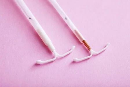 Mengenal KB IUD, Cara Kerja, dan Keunggulan, dan Efek Samping