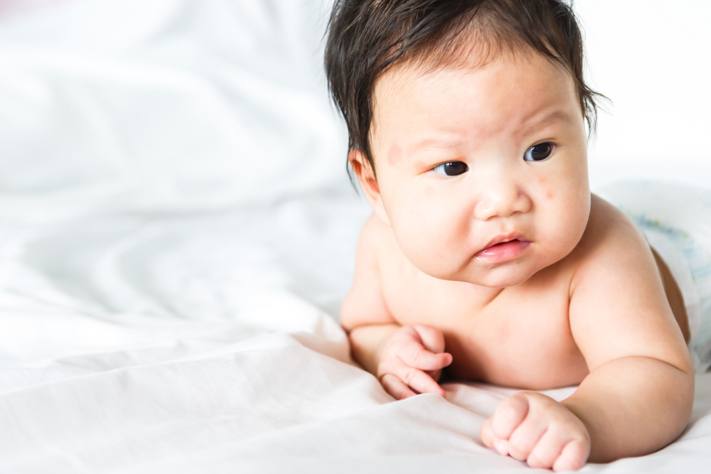 Mengulik Penyebab dan Cara Mengatasi Bisul pada Bayi