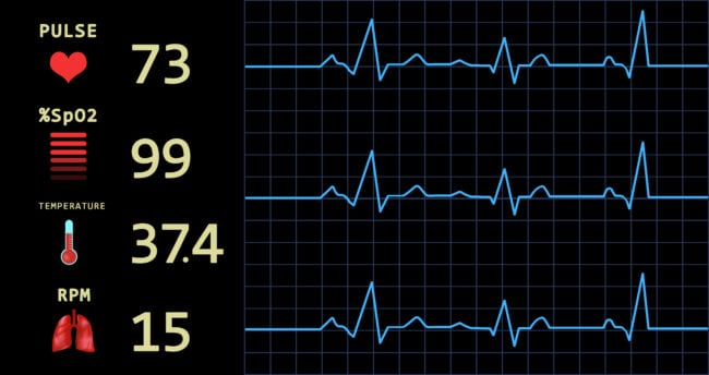 Cara Tepat Membaca Monitor ICU Di Rumah Sakit Hello Sehat