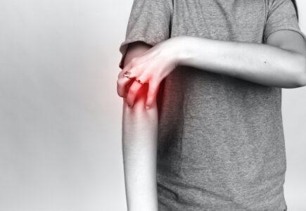 Serupa tapi Tak Sama, Ini Perbedaan Kudis dan Kurap