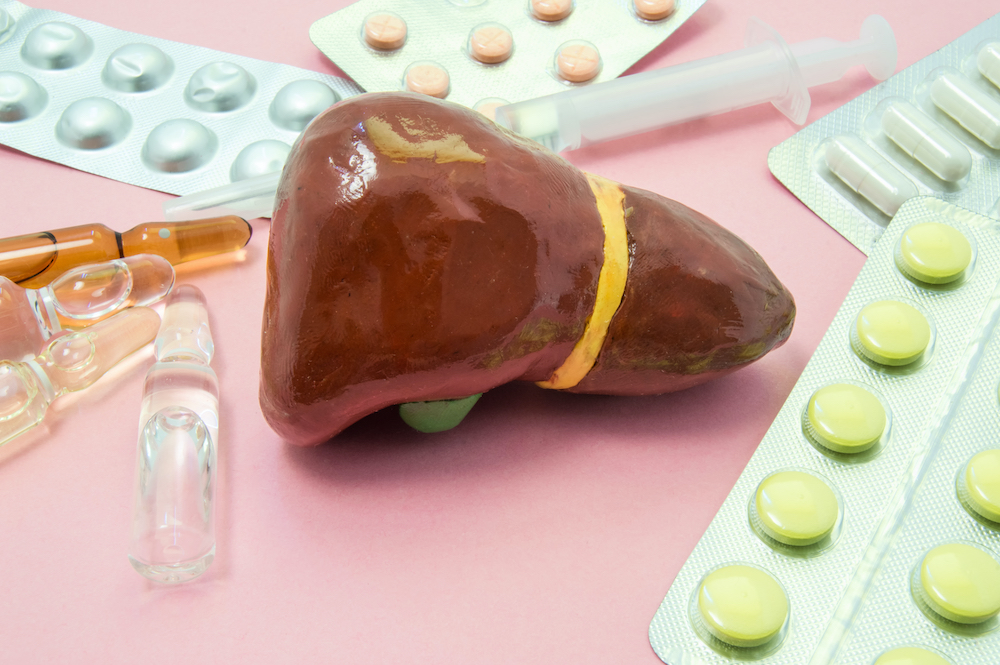 Cara Mengobati Penyakit Liver, dari Minum Obat hingga Operasi