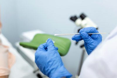 Pap smear dan vaksin HPV berguna untuk deteksi dan cegah kanker serviks