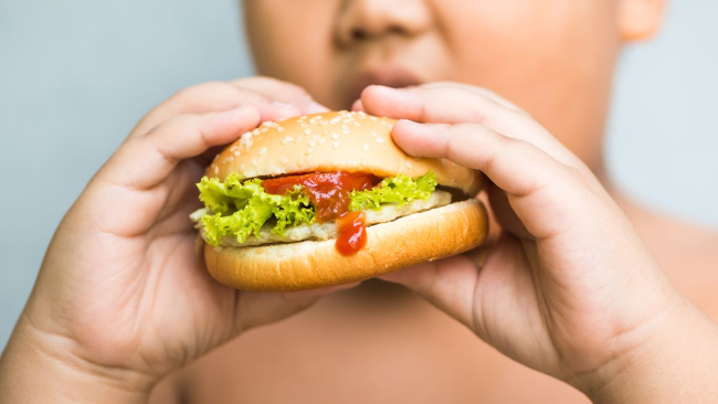 Mengenal 5 Penyebab dan Faktor Risiko Obesitas pada Anak