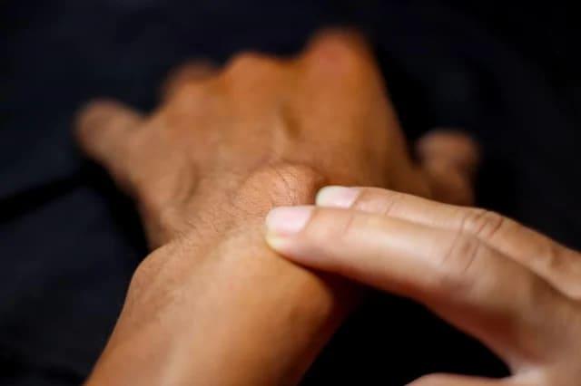 ganglion