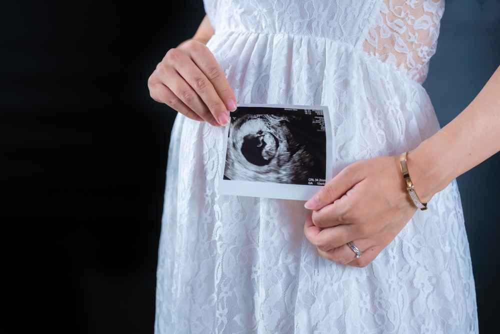 Perkembangan Janin pada Usia Kehamilan 10 Minggu