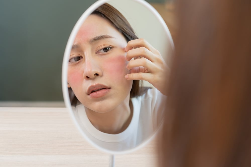 Skin Barrier Rusak, Apa Ciri-cirinya? Ini Cara Mengatasinya