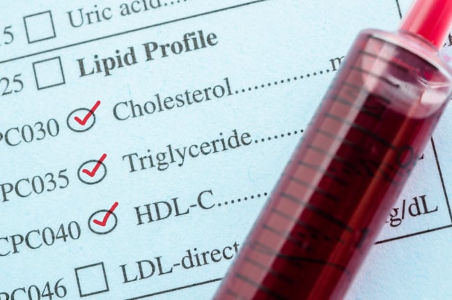 Mengetahui Batas Kadar Kolesterol Normal dalam Tubuh