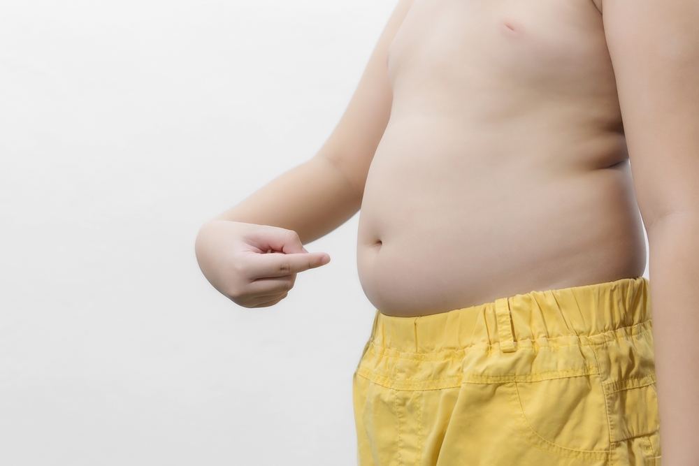 Stunted-Obesity, Anak Stunting Berisiko Alami Obesitas