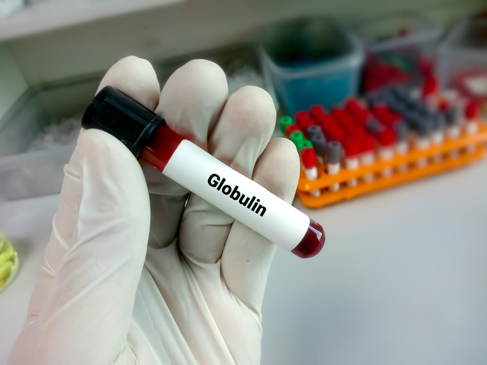 Mengenal Prosedur Tes Globulin untuk Diagnosis Penyakit