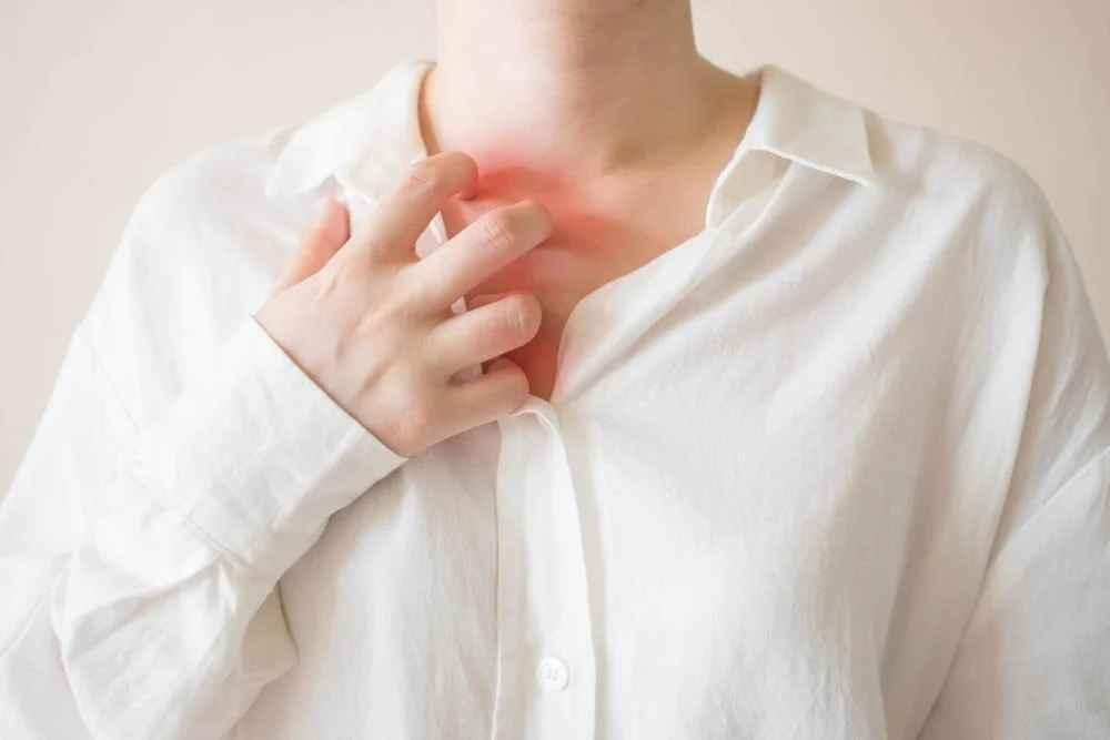 lyme-disease