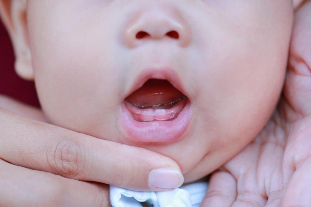 diarrhea-in-babies