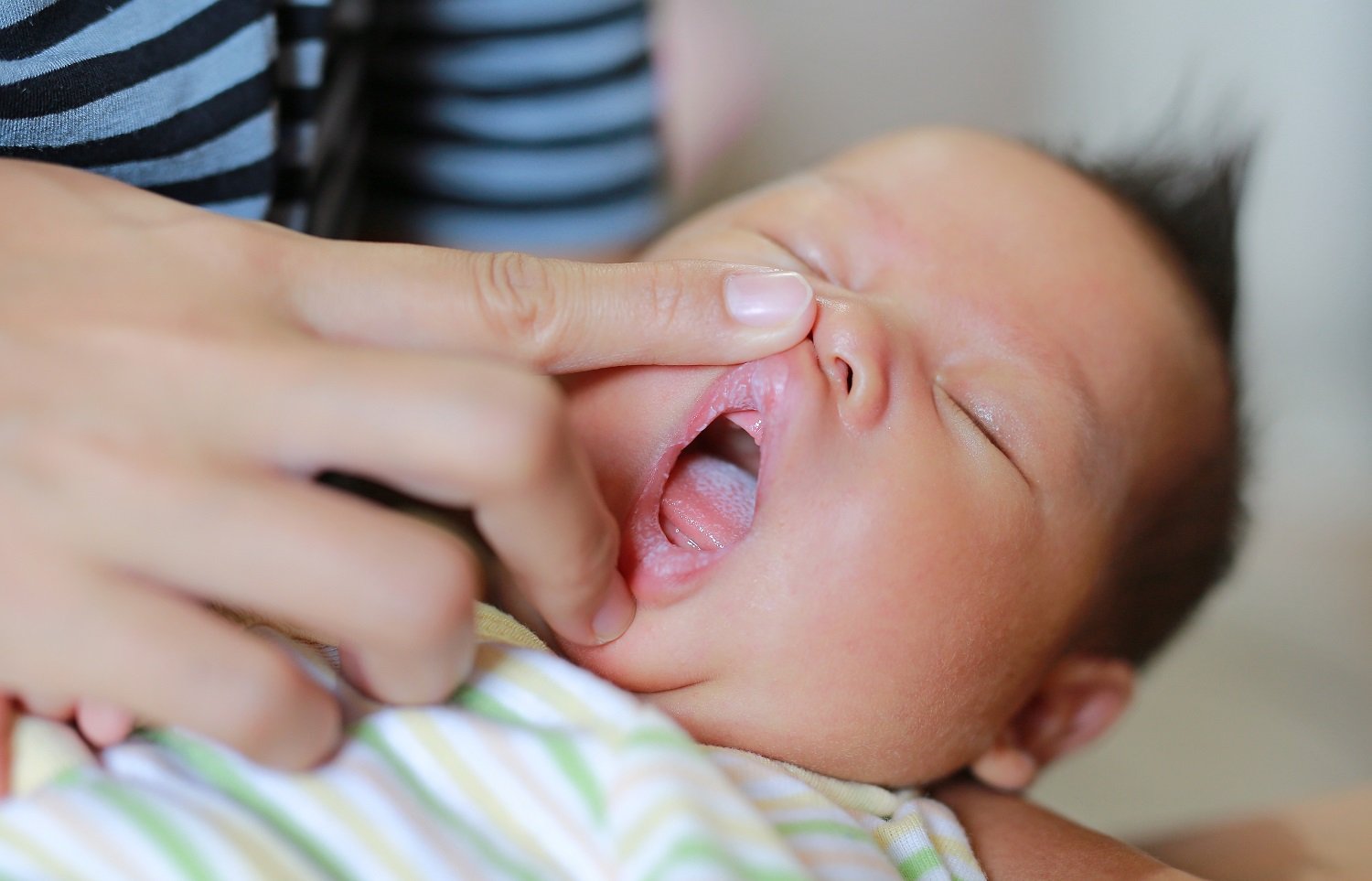 Memahami Penyebab Lidah Bayi Putih dan Cara Mengobatinya