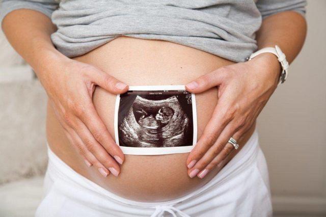 13 Tips untuk Ibu Hamil Tua Selama Trimester 3