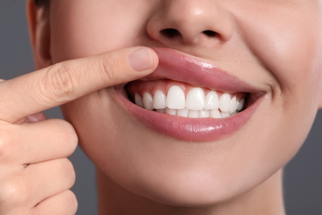Tak Perlu Repot, Ini 5 Cara Simpel Merawat Gigi dan Gusi