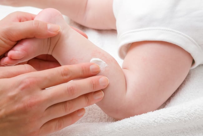 12 Rekomendasi Salep Biang Keringat Bayi di Apotek