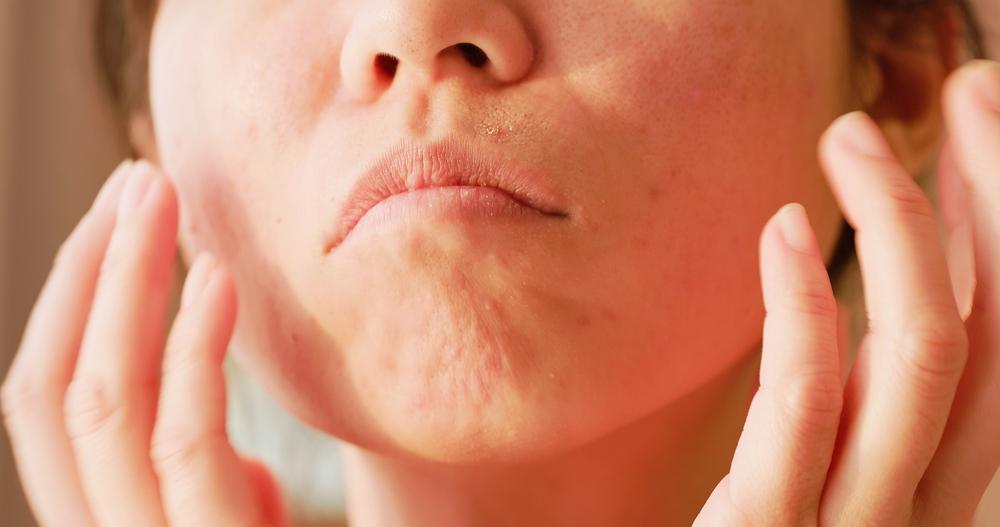 Penyebab Air Liur Keluar Berlebihan dan Tips Mengatasinya