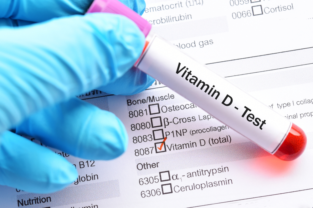 Tes Vitamin D