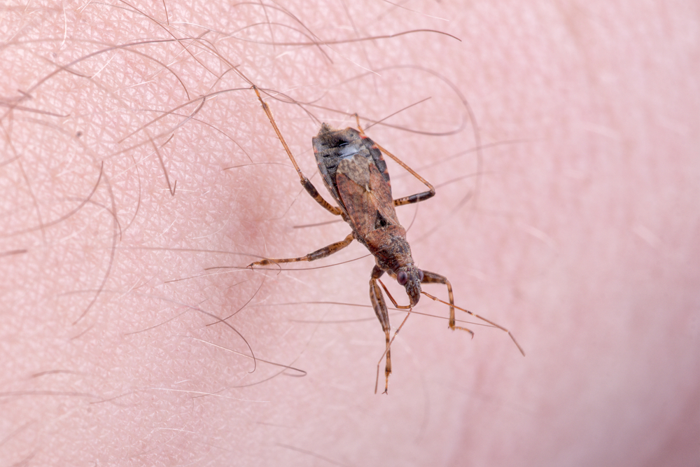 Penyakit Chagas